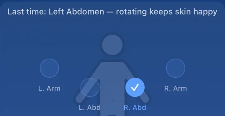 Injection site map in the app: last time left abdomen, this time right abdomen selected
